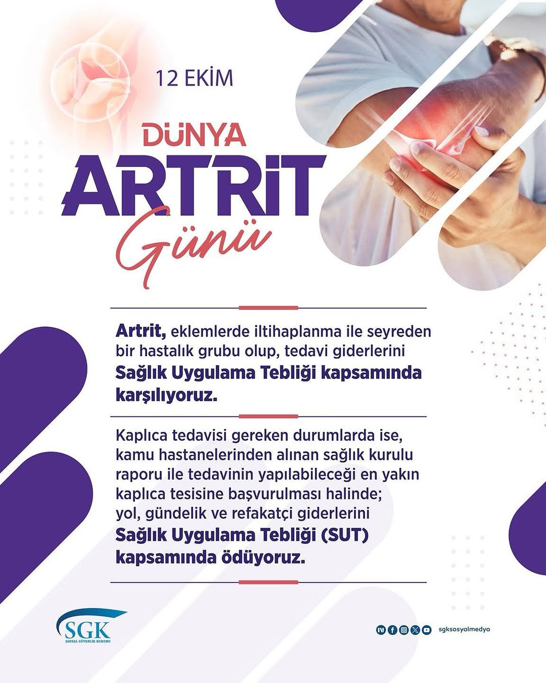 Artrit Hastalarının Tedavi Giderleri SGK Tarafından Karşılanacak